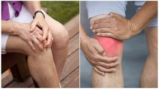 Symptoms of osteoarthritis