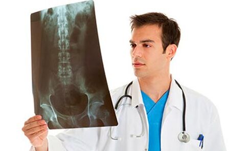 the doctor will look at an X-ray to diagnose lower back pain